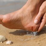 海で貝殻で足を切った時の正しい消毒方法。海水浴初心者が知るべき応急処置